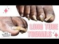 👣 Trim Long Toenails Tutorial 👣