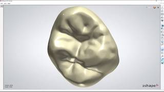 3shape STL export (use UDX file)