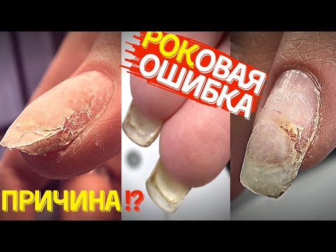 ГРУБЕЙШАЯ ОШИБКА в маникюре и ее последствия 😳🤯 НЕ ДЕЛАЙТЕ ТАК!