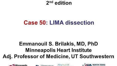 Case 50: Manual of CTO Interventions - LIMA dissection