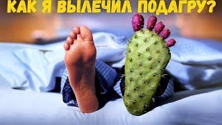 Как я вылечил подагру без таблеток? 1,5 года приступов нет!