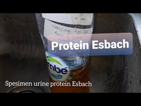 Spesimen Urine Esbach Protein 24 jam