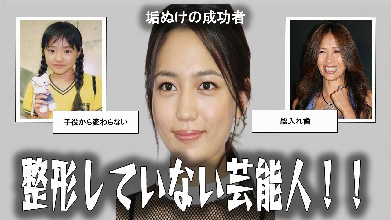 【雑談スレ】整形していない芸能人【ガルちゃん芸能人】