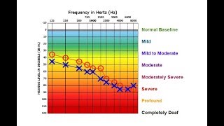 Audiogram SOAP Report