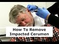 Removing Impacted Cerumen from a Patient's Ear