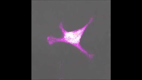 Incredible video captures T cells fighting cancer