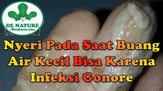 Nyeri Pada Saat Buang Air Kecil Bisa Karena Infeksi Gonore