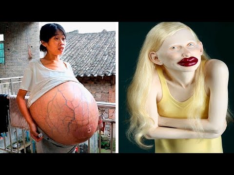 Video: Cei mai grași oameni din lume - câteva povești din viață