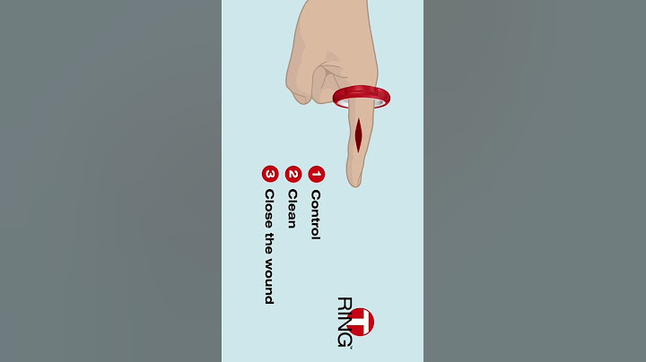 T-Ring | Finger Cut Medikit #shorts
