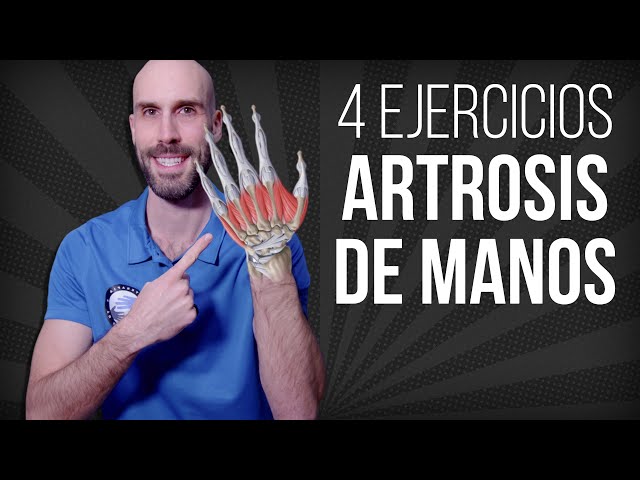 Todo lo que tienes que saber sobre la artrosis de muñeca y mano