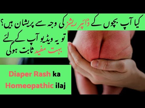 homeopathic-medicine-for-diaper-rash-|-irritant-diaper-dermatitis-|-diaper-rashes-ka-ilaj
