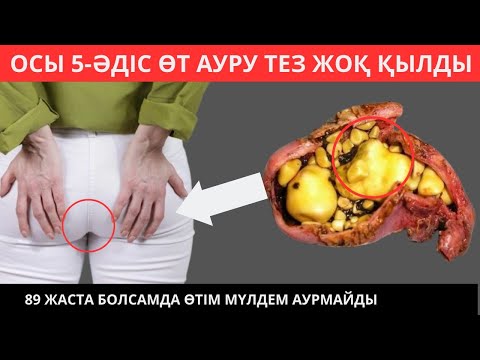 Бейне: Кассис сусыны дегеніміз не?