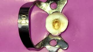 Warm Vertical Compaction