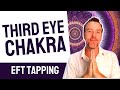 Open the Third Eye Chakra with EFT Tapping - Chakra Healing - Wisdom & Insight