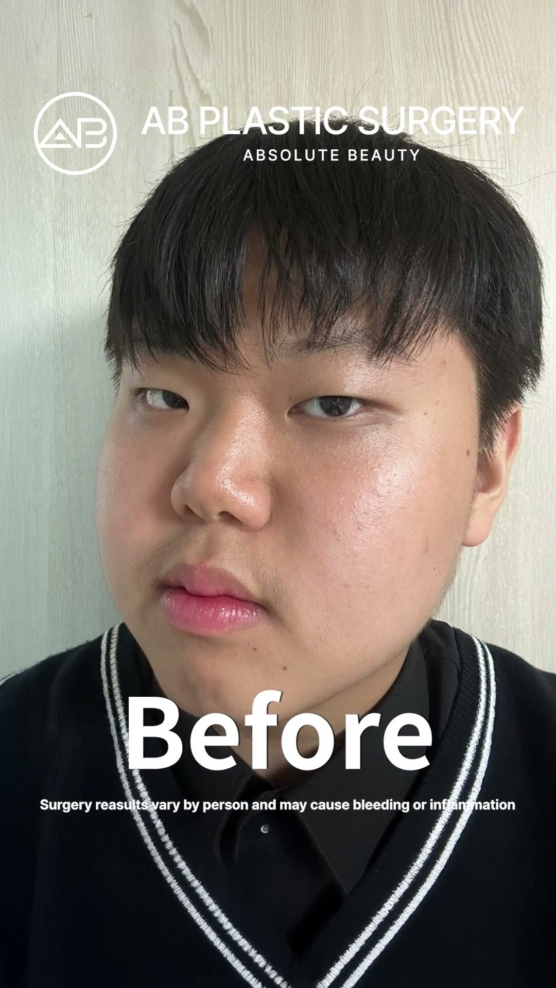 From Average to Unbelievable His Stunning Transformation #shorts
