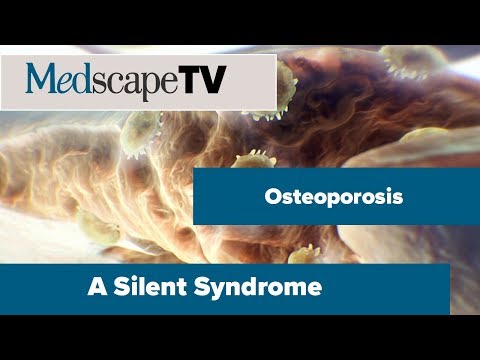 Osteoporosis: Protecting Bones, Preventing Breaks | MedscapeTV