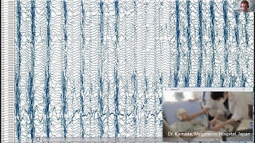 Invasive BCI and Brain Stimulation - Lecture from The BCI & Neurotechnology Spring School 2020