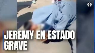 Jeremy, Alumno Apuñalado Tras Riña En Secundaria De Tláhuac Está En Estado Crítico
