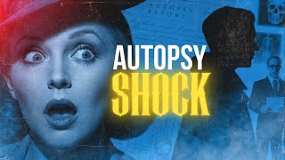 Terrifying AUTOPSY Reports of 15 Old Hollywood Celebrities – What Doctors Discovered Will Haunt You 