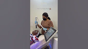 Carbon Laser Facial At Skinsa Clinic Say Hello To Clear Smooth Radiant Skin 