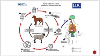 paraziták echinococcus hogyan kell kezelni