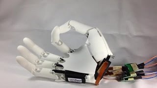 Celebrity Now that's wearable tech! Designer creates 3D printed bionic hand that you update like a smartphone Net Worth