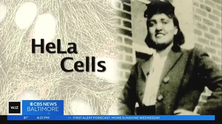 Historic Henrietta Lacks settlement paves the way for 'unjust enrichment' claims