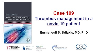 Case 109: PCI Manual - Large thrombus in a covid 19 patient