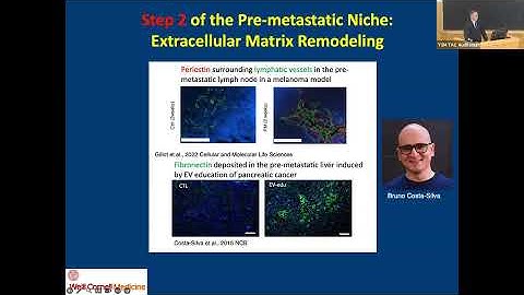 Tumor Extracellular Vesicles and Particles Promote Metastasis and Systemic Disease