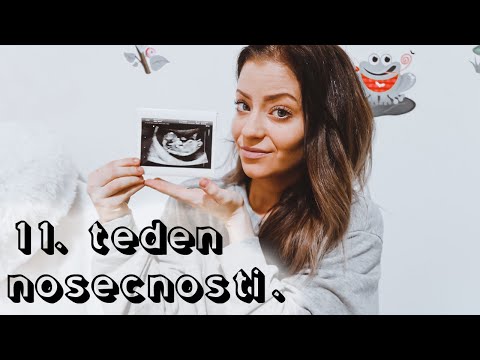 Video: Deseti Teden Nosečnosti