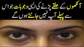 Dark Circles Kis Wajah Se hote hain | Shocking reason of dark circles