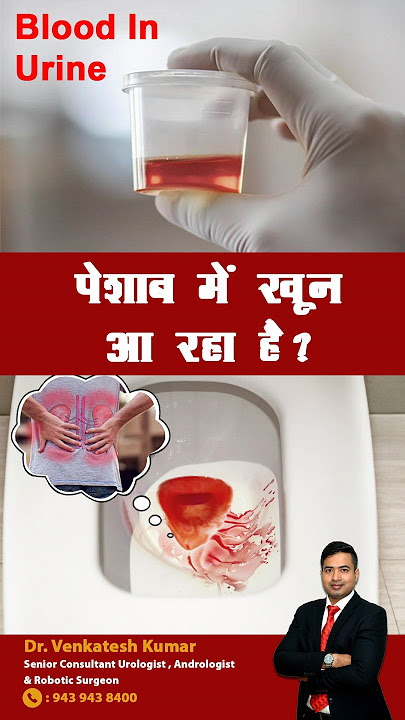 Blood 🩸In Urine 😱 | Hematuria #bloodinurine #drvenkatesh