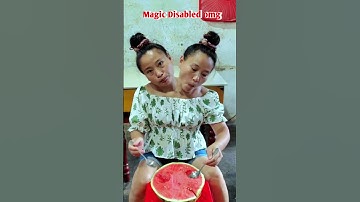 Thumbnail of Tasbih song | conjoined twins sister omg | new tiktok video#godblessyou#shorts#viralshorts#newtiktok