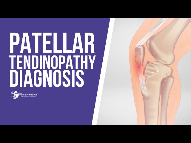 Patellar tendonitis and patellar tendinopathy