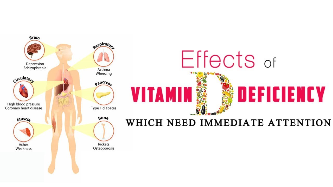 Effects of Vitamin D deficiency which need immediate attention YouTube