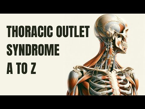 Unraveling Thoracic Outlet