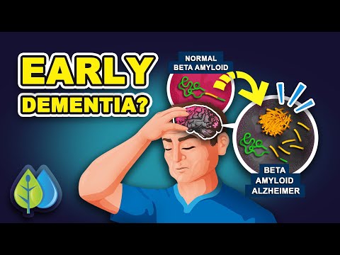 Top 10 Early Signs of Dementia - Reverse Naturally