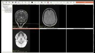 Simple DICOM image tools in JimboDICOMViewer