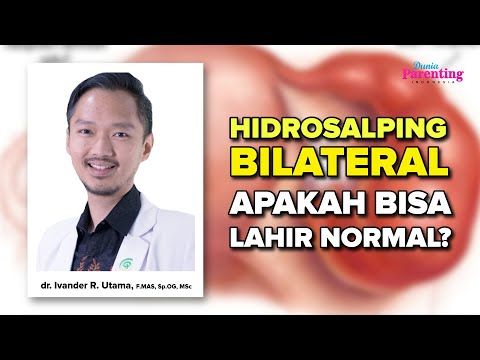 Video: Apa itu salpingektomi bilateral laparoskopi?