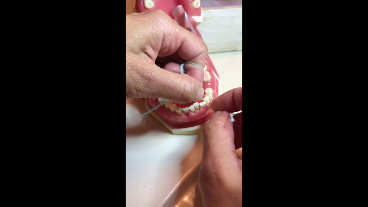 Proper flossing technique: C shape flossing demo by RDH - YouTube
