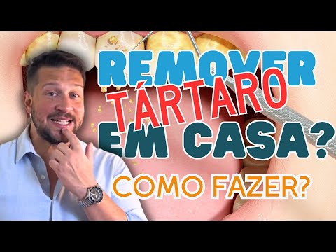 Como Remover Tartaro