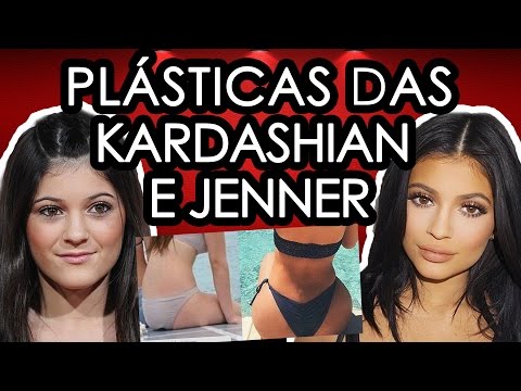 Vídeo: Kylie Jenner antes e depois da cirurgia plástica
