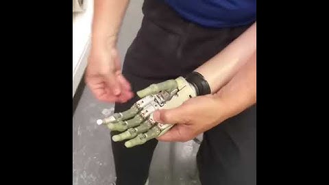 Replacing digits on a Touch Bionics