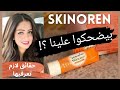 هل سكينورين كريم مقشر للوجه يستحق الشراء ايه علاقته بالاكريتين Skinoren Cream Acretin Cream
