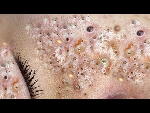 ผลสลากกินแบ่งรัฐบาล วันที่ 1 พย. 2567