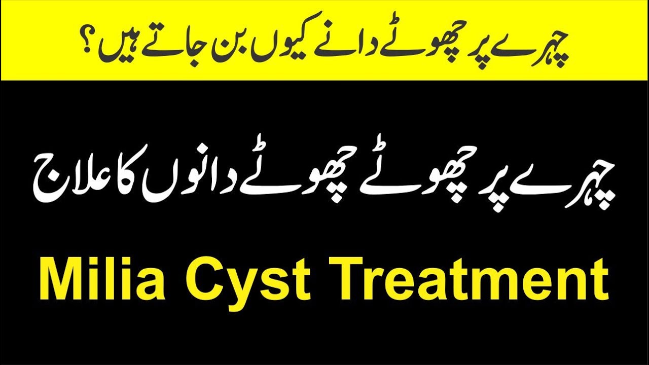 face par chote chote dano ka ilaj | how to get rid of milia on face | 