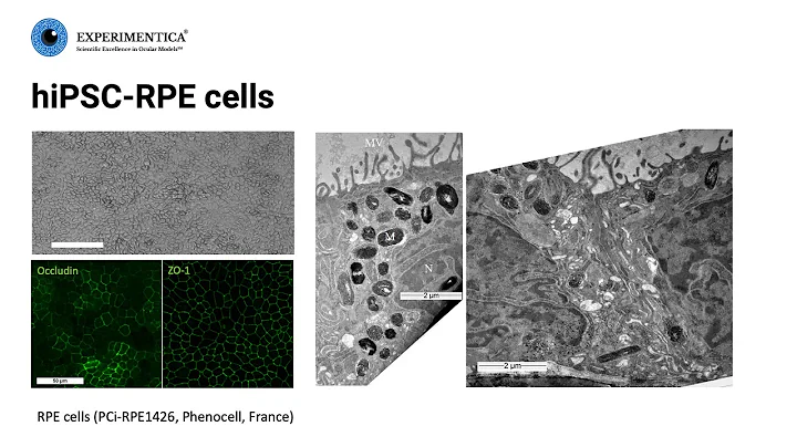 Preclinical models for drug discovery in dry age-related macular degeneration