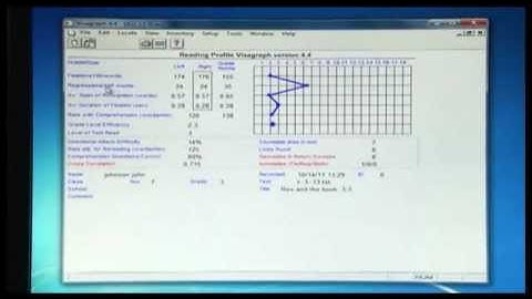 Wise Eye - Visagraph