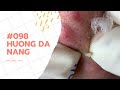 #098 | Huong Da Nang