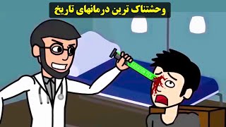 چهار مورد از وحشتناک ترین درمان های پزشکی در تاریخ